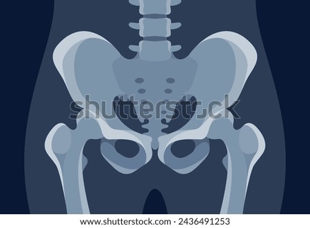 Xray of hip joint pelvis human bones anatomy orthopedic medical diagnostic vector flat illustration. X ray roentgen radiology shot surgery femur healthy skeleton spine anatomical structure image