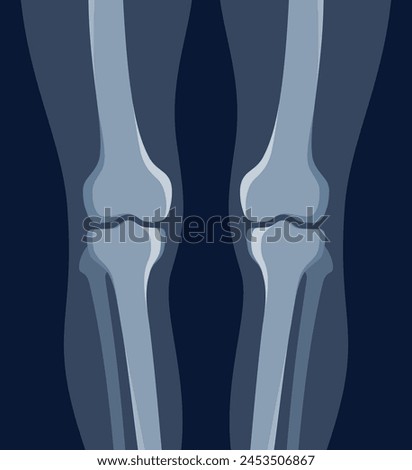 Knee human legs x ray roentgen radiology shot medical healthcare vector flat illustration. Foot feet bones skeleton structure xray image joint limbs diagnostic orthopedic surgery check treatment