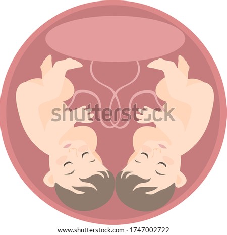 image of two identical embryos in the uterine cavity with one placenta.
stock isolated illustration on white background for printing on postcards, websites, shop advertising in cartoon style