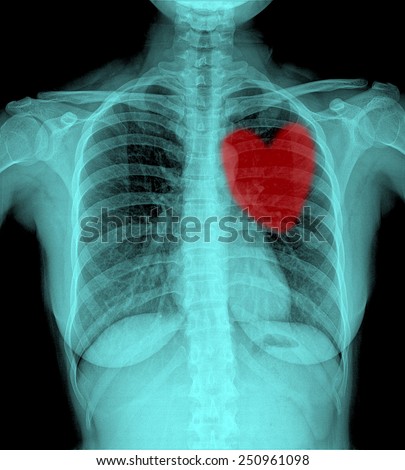 X-Ray Image Of Women Chest,red heart
