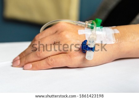 A catheter into the back of hand vein  Foto stock © 