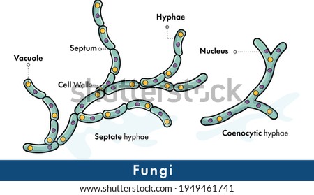 Structure of fungi, septate and coenocytic hyphae.