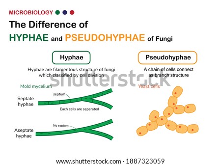 Biology diagram show difference of true hyphae (hypha) in fungi mold with pseudohyphae in yeast