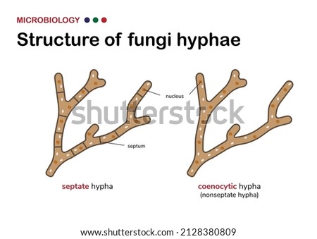microbiology illustration show different structure of fungi hypha (hyphae) comparison between septate and aseptate (coenocytic) hypha 