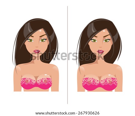 Woman before and after plastic surgery breast augmentation