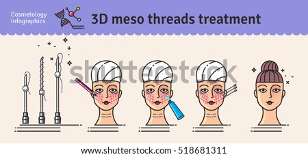 Vector Illustrated set with 3d Meso Thread Face Lift therapy. Infographics with icons of medical cosmetic procedures for skin.