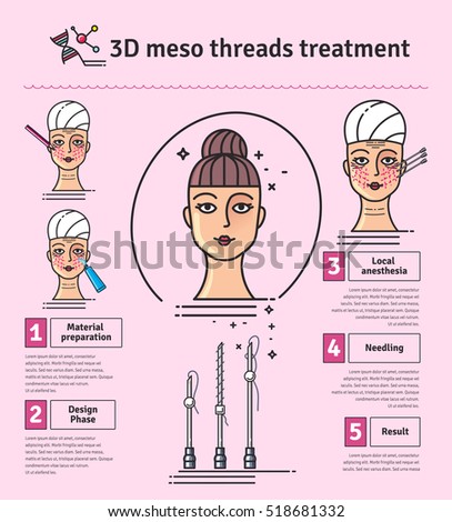 Vector Illustrated set with 3d Meso Thread Face Lift therapy. Infographics with icons of medical cosmetic procedures for skin.