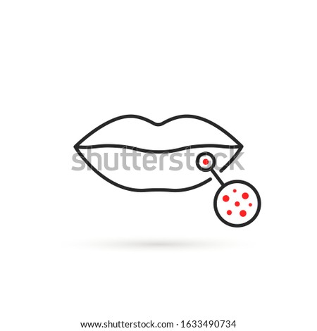 black thin line lips with red rash. flat linear style trend modern logotype graphic art design element isolated on white background. concept of inflammation on face or allergic and infectious rash