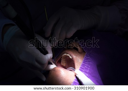 Asian male patient during treatment with dentist, Selective focus