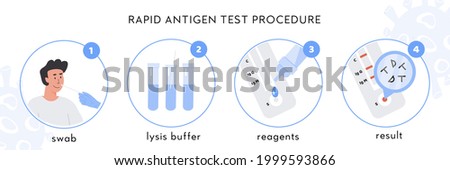 Covid-19 Rapid Antigen test procedure Infographic. A doctor takes nasal swab from male patient. Coronavirus swap sample in lysis buffer, strip with reagents and result with antigen molecules. Vector.