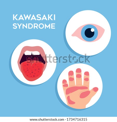 Vector illustration of Kawasaki disease symptoms
