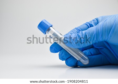 A blue-gloved hand holds a test tube with a blue stopper . copying a space. There is space for the text. Medical equipment Foto stock © 