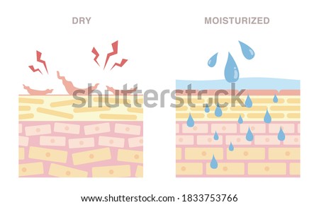 Skin cross section of dry, and moisturized.  Pale colored illustration in flat cartoon style.