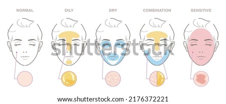 Types of women's skin problems. Normal, oily, dry, combination, sensitive. Vector illustration isolated on white background.