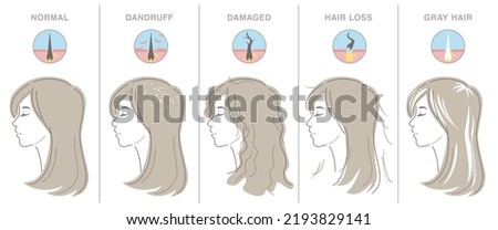 Types of women's hair problems. Profile of young woman, and hair cross section icon. Normal, dandruff, damaged, hair loss, gray hair. Vector illustration isolated on white background.