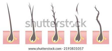 Types of hair problems cross section. Normal, split ends, damaged, break off, frizz. Vector illustration isolated on white background.