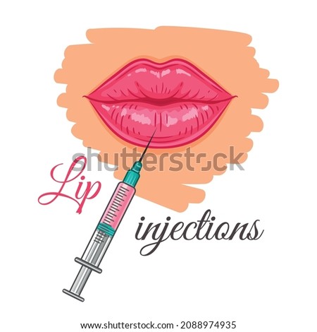 Lip syringe injection for augmentation by hyaluronic acid filler. Medical beauty face procedure. Cosmetological correction woman mouth. Skin lifting and rejuvenation. Aesthetic plastic surgery. Vector