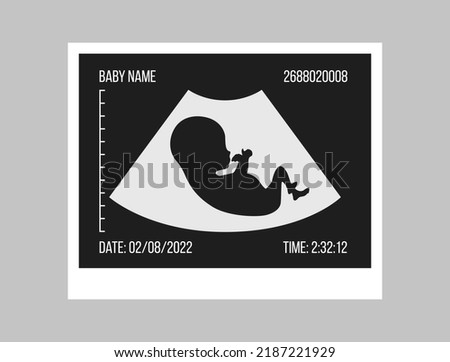 Pregnancy ultrasound black and white picture. Baby in the womb. Little baby silhouette medical photo. Pregnant woman clinic examination. Embryo human vector illustration. Sonography test. Belly scan Stockfoto © 