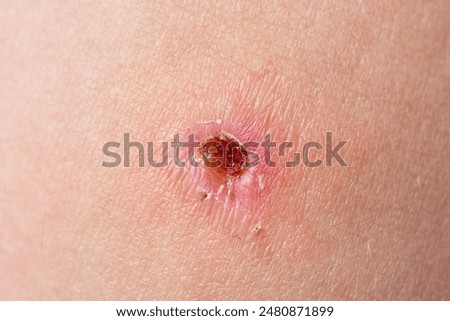 Similar – Image, Stock Photo wound healing