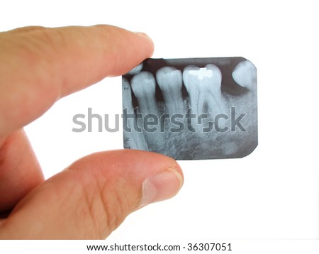 Posterior Periapical Film Radiograph Being Examined By A Dentist. Stock ...