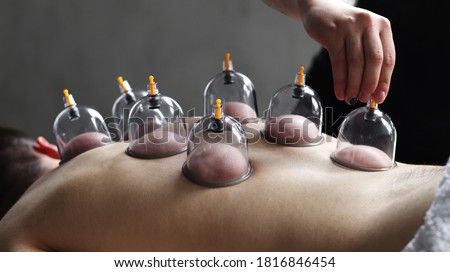 Cup massage close up. Banks for massage on the man's back. Massage with vacuum cups.