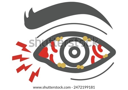 Mucous membrane pemphigoid,Cicatricial,chronic autoimmune causing blistering and scarring of the mucous membranes, including the eyes,Stevens-Johnson syndrom,ocular,Mooren's ulcer