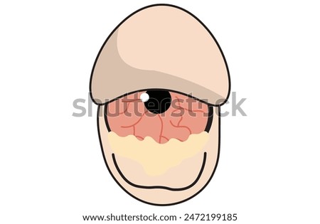 Mucous membrane pemphigoid,Cicatricial,chronic autoimmune causing blistering and scarring of the mucous membranes, including the eyes,Stevens-Johnson syndrom,ocular,Mooren's ulcer