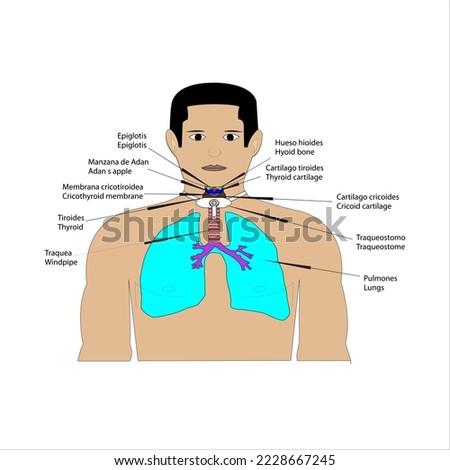 Anatomy topografhy of the a patient with tracheostome front view hyoid bone epiglottis thyroid cartilage Adan s apple cricoid cartilage thyroid cricothyroid membrane windpipe lungs