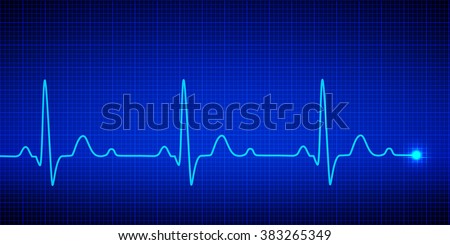 Heart pulse graphic. Vector illustration.