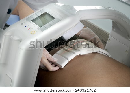 BODY FAT MEASURING - A close up of a patient having their body fat measured