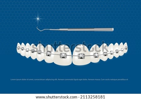 3d vector illustration, realistic teeth with braces. Alignment of the bite of teeth, dentition with braces, dental braces.