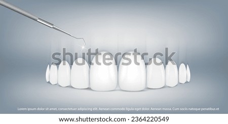 3d vector illustration, realistic teeth with braces upper and lower jaw. Alignment of the bite of teeth, dentition with braces, dental braces