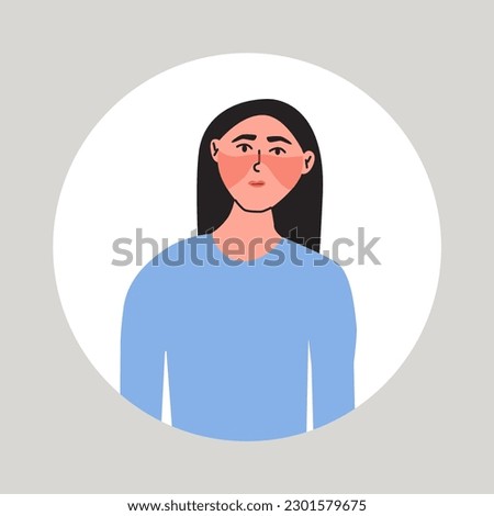 Young women suffering from a flushed face. Female with health problem. Hot flashes, symptom of menopause. Flat vector medical illustration.
