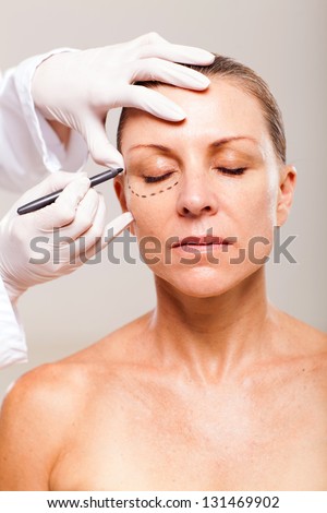 doctor draw correction lines on senior woman face before plastic surgery