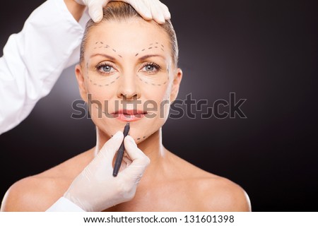 mid age woman with correction mark for plastic surgery