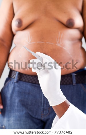 plastic surgery for overweight african american