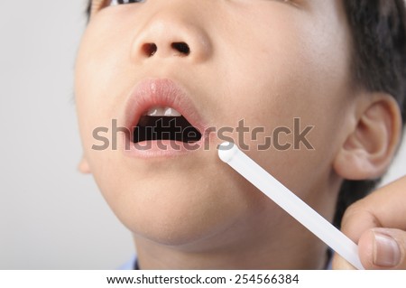 Herpes on kid mouth point by white stick