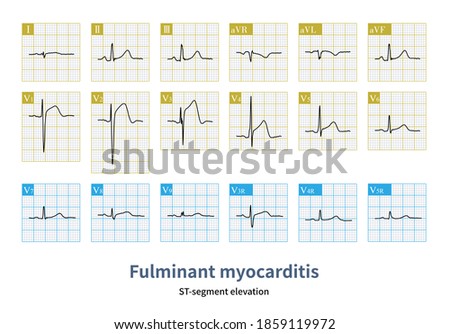 Shutterstock Puzzlepix