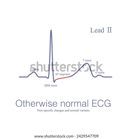 Similar – Image, Stock Photo sometimes there are no words…
