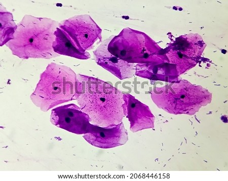 Buccal smear showing desquamated squamous cells of the oral mucosae. Small bluish points located mainly on the right cell are bacteria. Light micrograph. HE stain. Foto d'archivio © 