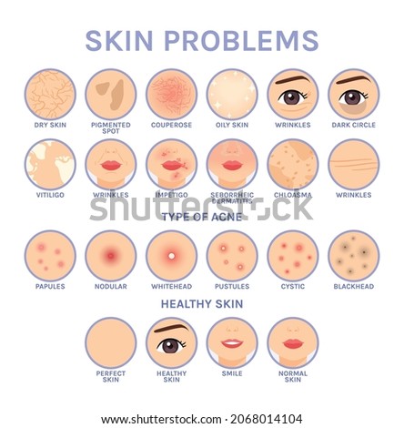 Skin Problems. Set of Icons for Different Skin Diseases of Face. Before After. Healthy Perfect Clean skin. Illustration for Medical and Cosmetic Design. White background. Flat Cartoon style. Vector.