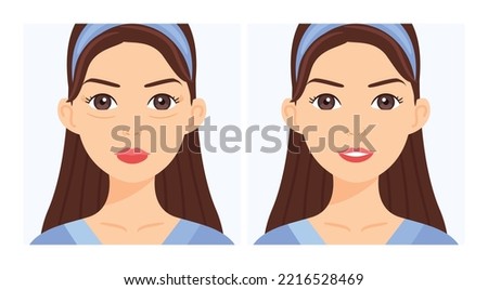 Woman with Wrinkles Around her Eyes. Wrinkle Treatment. Blephoroplasty. Before After. Young Skin and a Happy Lady. Color Cartoon style. White background. Vector illustration for Beauty Cosmetic Design