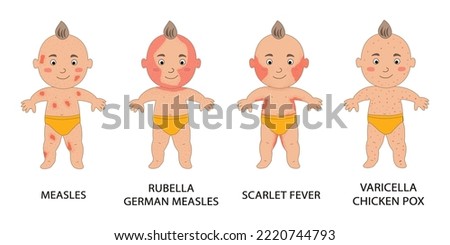 Infographics of childhood rash, measles, rubella, scarlet fever, varicella. Poster with a baby with chickenpox.