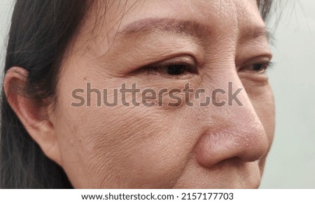portrait showing the flabbiness and wrinkles skin under the eyes, problem flabby skin on the face of the woman, concept health care. Foto d'archivio © 