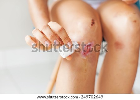 wound processing