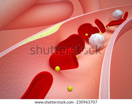 3D modeling of vein with fat in the walls, sectioned, showing blood cells and medicine.