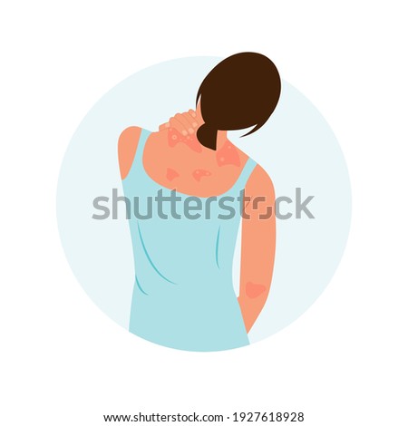 The woman is scratching her back. Allergic itching, skin inflammation, redness and irritation. Atopic dermatitis, eczema, psoriasis, dry skin. Skin problems Concept, isolated, vector.