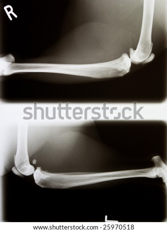 x-ray of a cat\'s leg