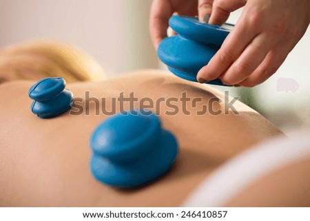 Close-up of woman having cupping therapy