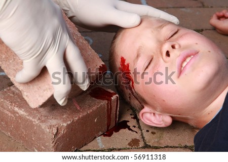 A boy lying down with blood on his head from an injury and helping hands with gloves nearby.